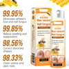 1+1 GRATIS | Venomix™ Schluss mit Nagelpilz in nur 2 Wochen!