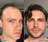 1+1 GRATIS | GlowMane™ Genießen Sie kräftiges und gesundes Haar!
