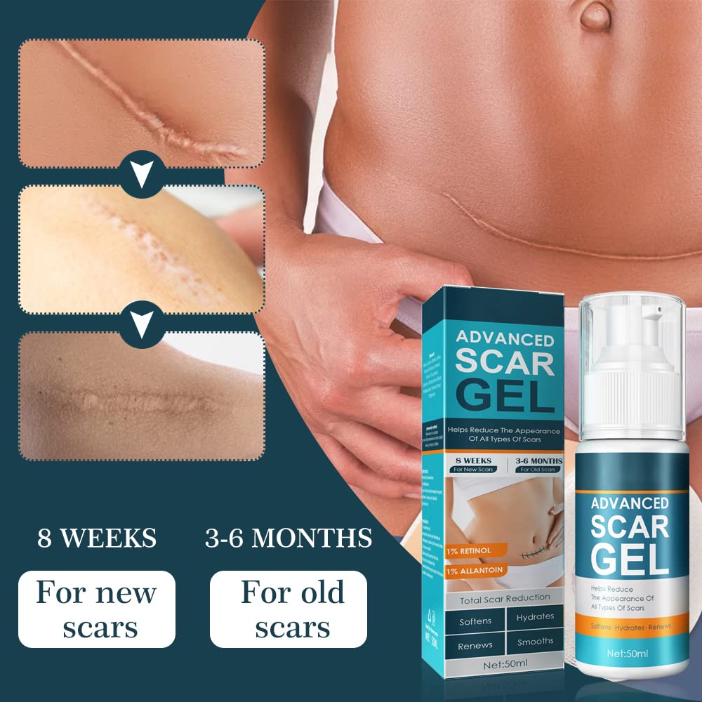 1+1 GRATIS | ScarEase™ Glättet die Hautstruktur!