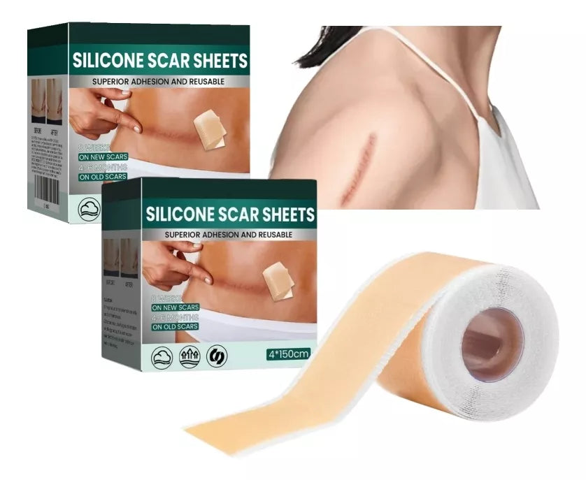 1+1 GRATIS | ScarPatch™ Die effektive Lösung gegen Narben & Dehnungsstreifen!
